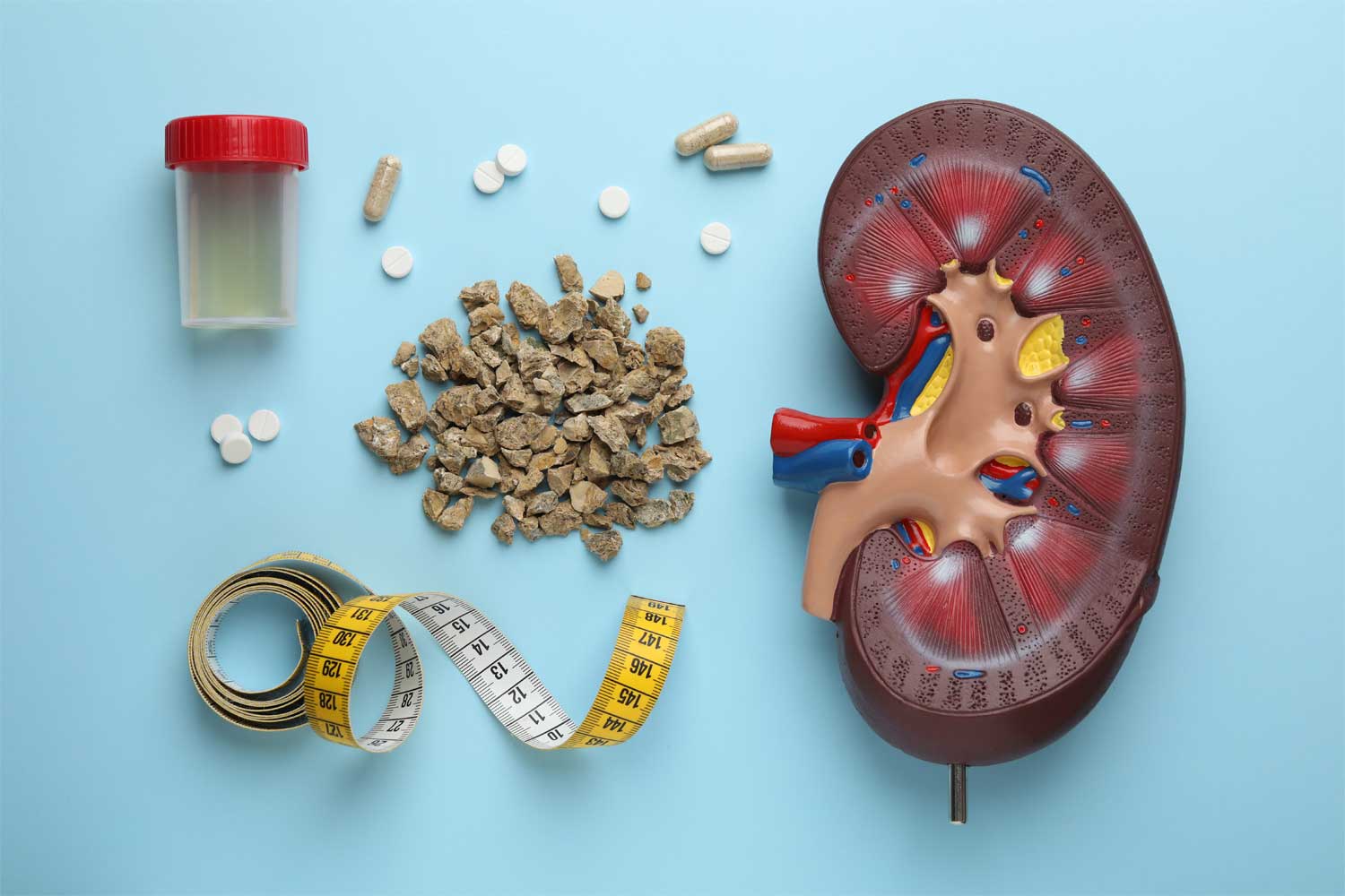 Medicamente pentru eliminarea pietrelor la rinichi